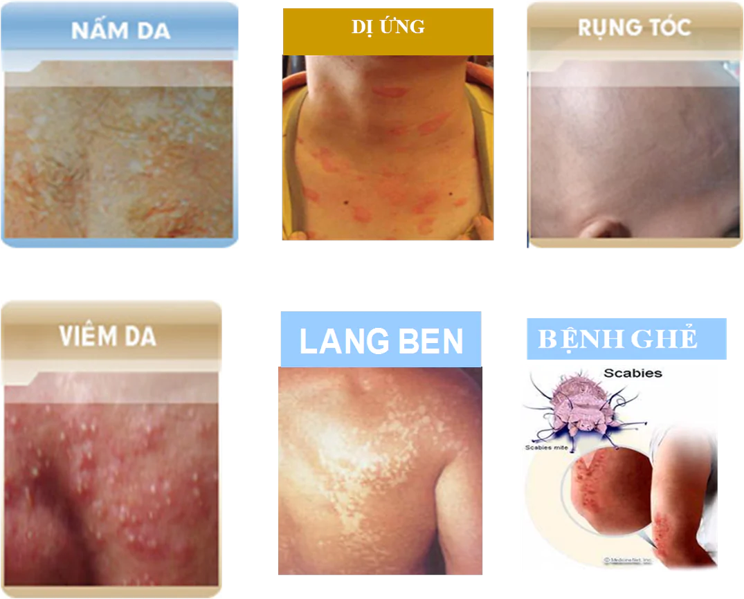 Bài 42. VỆ SINH DA