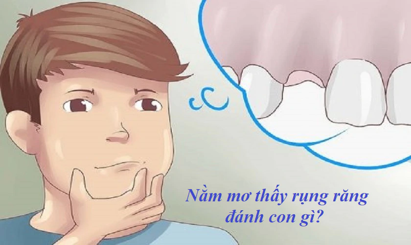 hinh-anh-nam-mo-bi-gay-rang-thi-lam-diem-bao-gi-khi-danh-de-663-0 hinh-anh-nam-mo-bi-gay-rang-thi-lam-diem-bao-gi-khi-danh-de-663-0