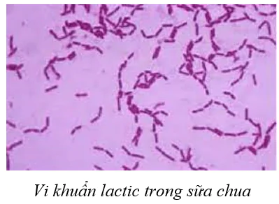 hinh-anh-bai-23-thuc-hanh-mot-so-phuong-phap-nghien-cuu-vi-sinh-vat-thong-dung-3738-1
