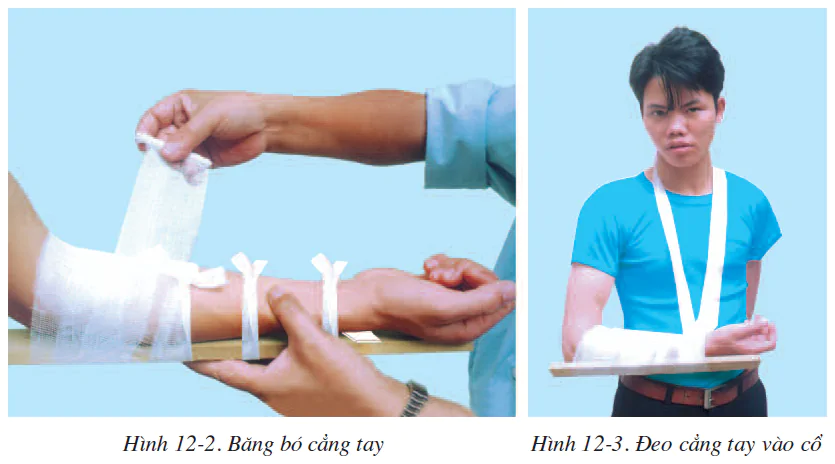 hinh-anh-bai-12-thuc-hanh-tap-so-cuu-va-bang-bo-cho-nguoi-gay-xuong-2503-1