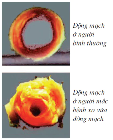 hinh-anh-bai-16-tuan-hoan-mau-va-luu-thong-bach-huyet-2509-3