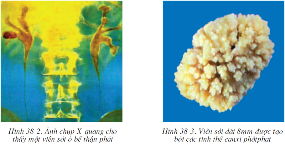 hinh-anh-bai-38-bai-tiet-va-cau-tao-he-bai-tiet-nuoc-tieu-2535-1