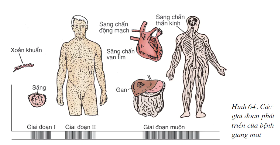 hinh-anh-bai-64-cac-benh-lay-truyen-qua-duong-sinh-duc-benh-tinh-duc-2609-0