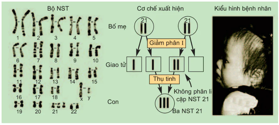 hinh-anh-bai-21-di-truyen-y-hoc-3135-0