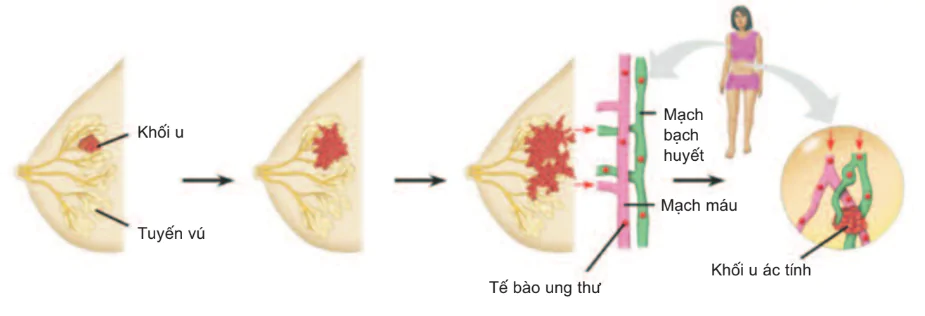 hinh-anh-bai-21-di-truyen-y-hoc-3135-1
