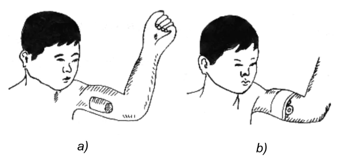 hinh-anh-bai-7-ki-thuat-cap-cuu-va-chuyen-thuong-3303-5