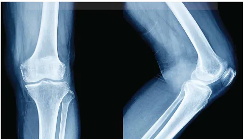 hinh-anh-bai-5-tia-x-13913-4