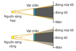 hinh-anh-bai-6-chup-x-quang-chup-cat-lop-13914-4