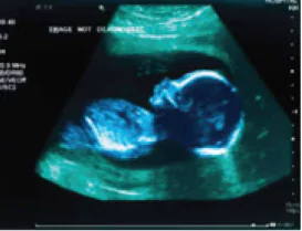 hinh-anh-bai-7-sieu-am-13915-3 hinh-anh-bai-7-sieu-am-13915-3