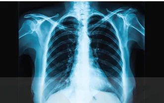 hinh-anh-bai-6-chup-x-quang-chup-cat-lop-13914-2