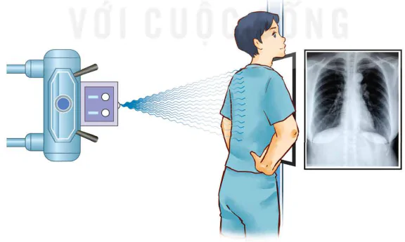 hinh-anh-bai-6-chup-x-quang-chup-cat-lop-13914-1