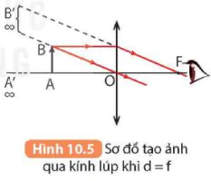 hinh-anh-bai-10-kinh-lup-bai-tap-thau-kinh-5714-8