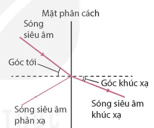 hinh-anh-bai-7-sieu-am-13915-2 hinh-anh-bai-7-sieu-am-13915-2