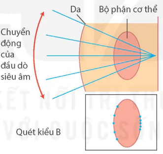 hinh-anh-bai-7-sieu-am-13915-6 hinh-anh-bai-7-sieu-am-13915-6