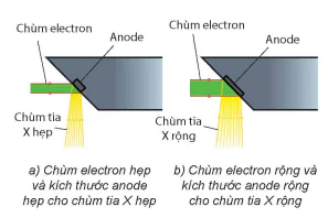 hinh-anh-bai-6-chup-x-quang-chup-cat-lop-13914-5