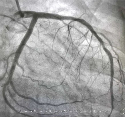 hinh-anh-bai-6-chup-x-quang-chup-cat-lop-13914-3