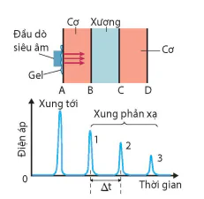 hinh-anh-bai-7-sieu-am-13915-5 hinh-anh-bai-7-sieu-am-13915-5
