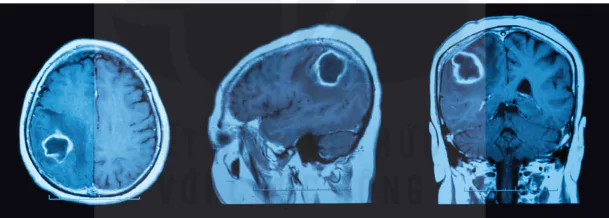 hinh-anh-bai-8-chup-cong-huong-tu-13916-2