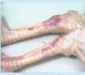 hinh-anh-bai-13-mot-so-benh-pho-bien-o-gia-cam-va-bien-phap-phong-tri-12200-3