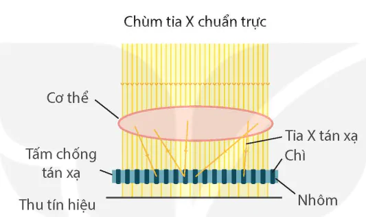hinh-anh-bai-6-chup-x-quang-chup-cat-lop-13914-6
