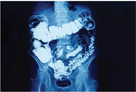 hinh-anh-bai-6-chup-x-quang-chup-cat-lop-13914-7