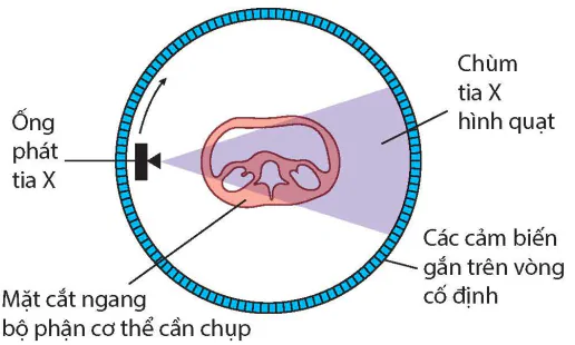 hinh-anh-bai-6-chup-x-quang-chup-cat-lop-13914-8