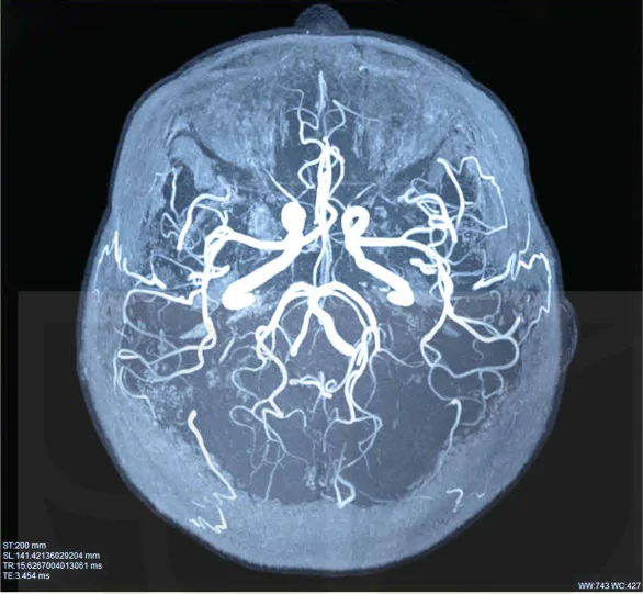 hinh-anh-bai-6-chup-x-quang-chup-cat-lop-13914-9