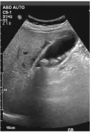 hinh-anh-bai-7-sieu-am-13915-9 hinh-anh-bai-7-sieu-am-13915-9